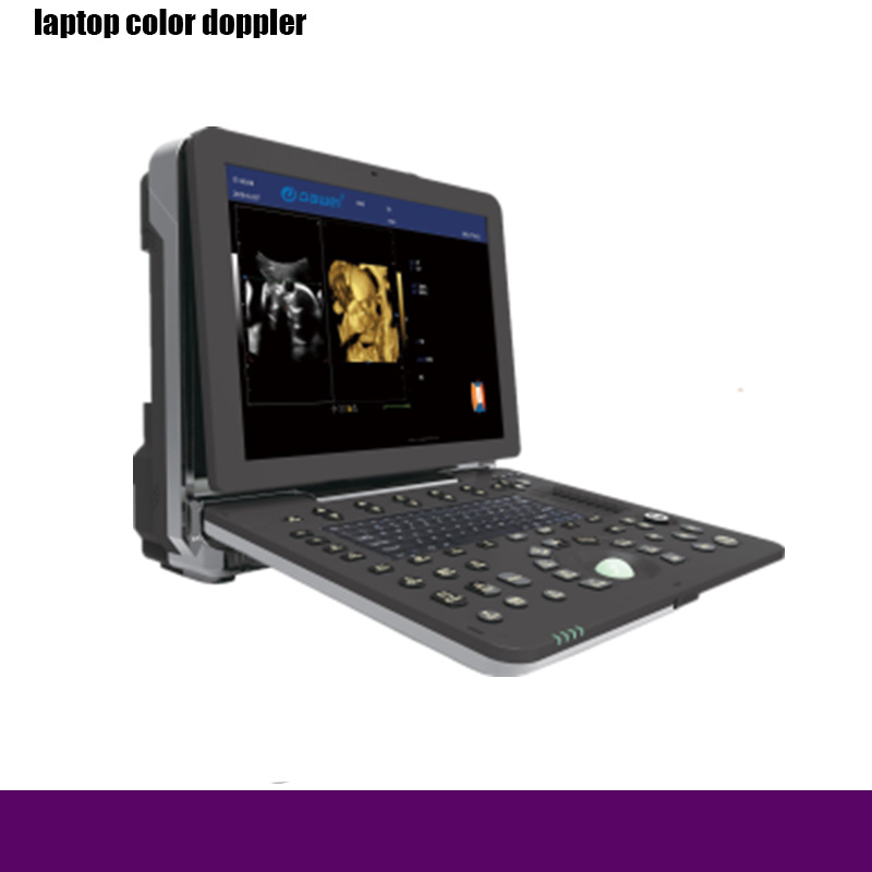 Rh-E9p6 Laptop Color Doppler to Hospital Medical Equipment