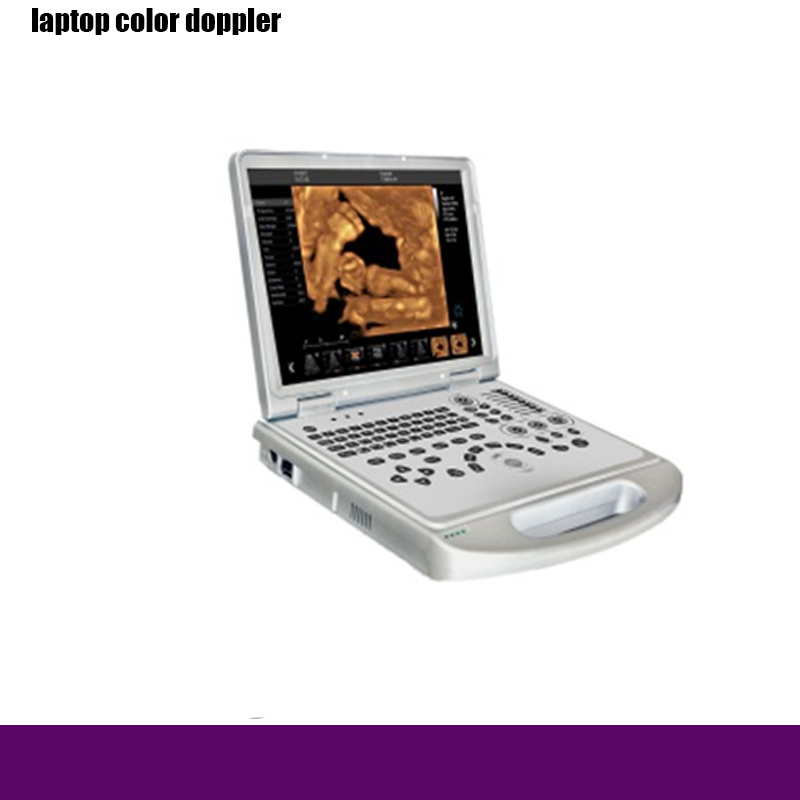 Rh-E9l5 Laptop Color Doppler to Hospital Medical Equipment