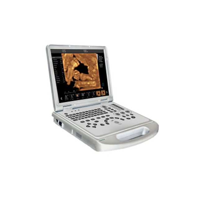 Rh-E9l5 Laptop Color Doppler to Hospital Medical Equipment