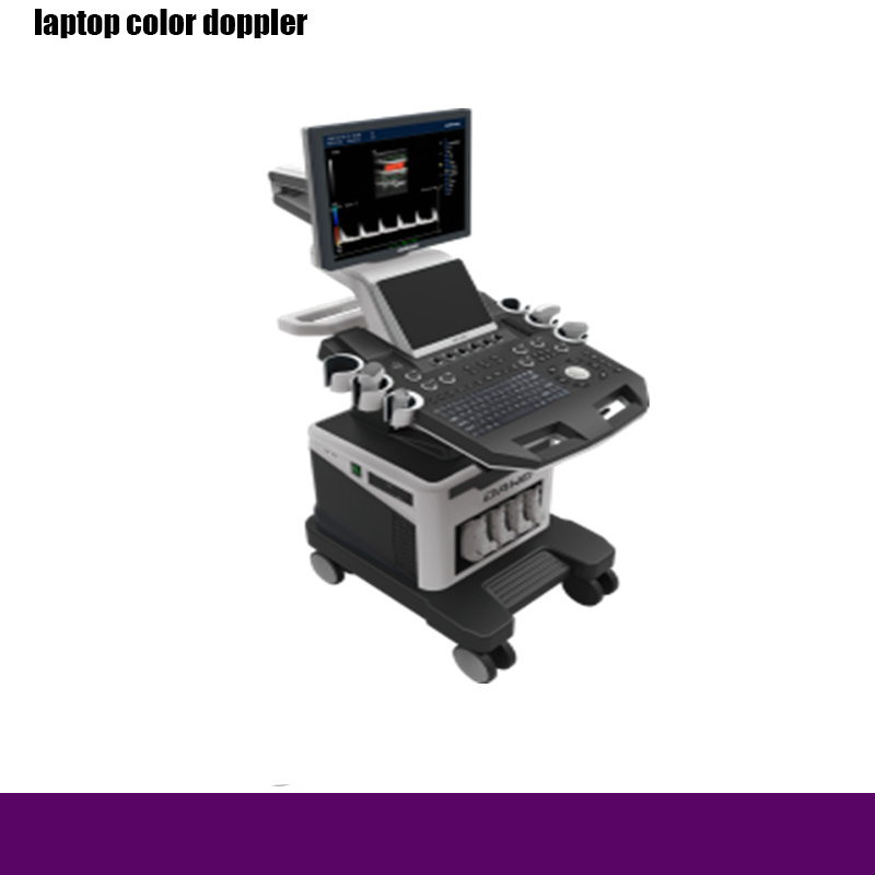 Rh-E9t5 Trolley Color Doppler to Hospital Medical Equipment