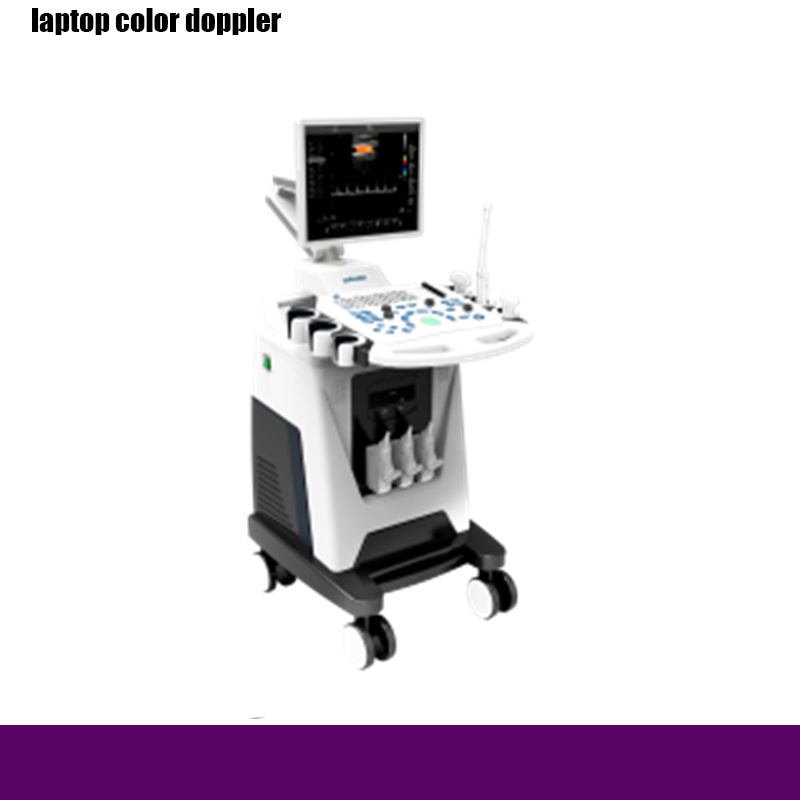 Rh-E9f3 Trolley Color Doppler to Hospital Medical Equipment