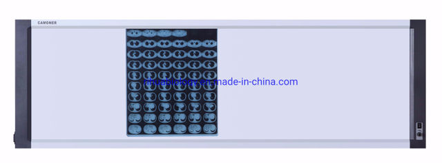 Quadruple Knob Dimming Film Viewer T=to Hospital Equipment