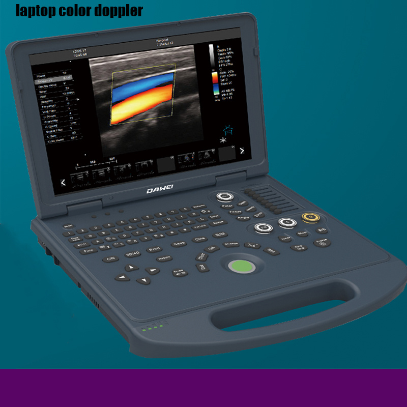 Rh-E9l3 Laptop Color Doppler to Hospital Medical Equipment